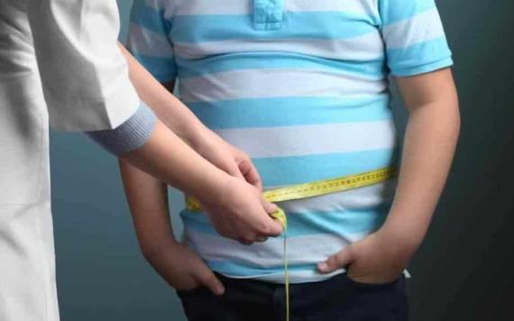 Tabasco ocupa el primer lugar a nivel nacional en casos de obesidad infantil