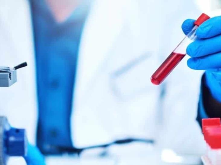 ¿Qué grupo sanguíneo tiene más probabilidad de padecer Alzheimer? ¿Qué grupo sanguíneo tiene más probabilidad de padecer Alzheimer?