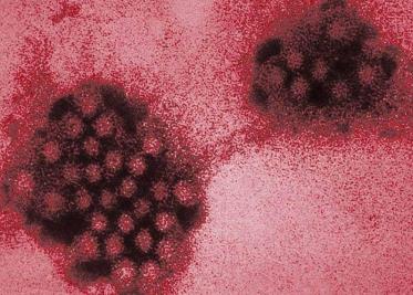 Mayores de 50 años deben vacunarse contra el herpes zóster