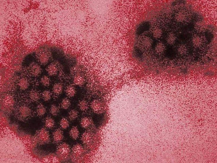 Mayores de 50 años deben vacunarse contra el herpes zóster Mayores de 50 años deben vacunarse contra el herpes zóster