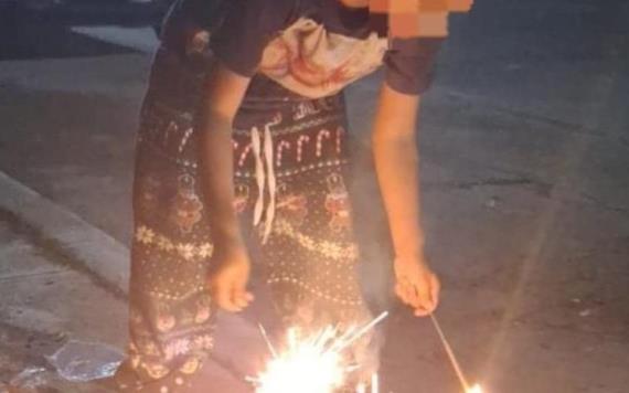 Alerta IMSS Tabasco sobre alta incidencia de quemaduras en menores de edad durante fiestas decembrinas