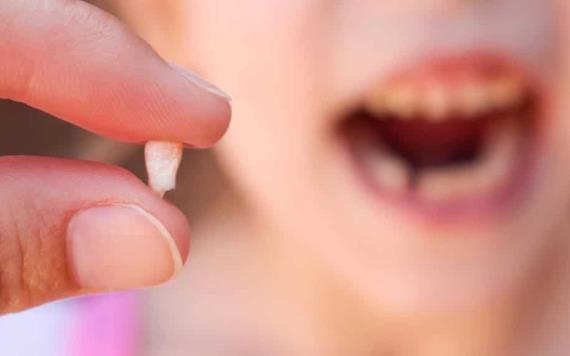 Niño de 5 años muere tras extracción de dientes de leche