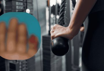 Mujer pierde dedo en una pelea con otra usuaria en gimnasio de Monterrey