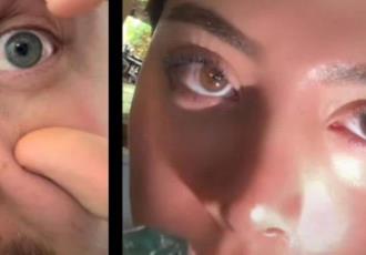Usuarios reportan Problemas en su pupila después de ver un eclipse solar sin protección