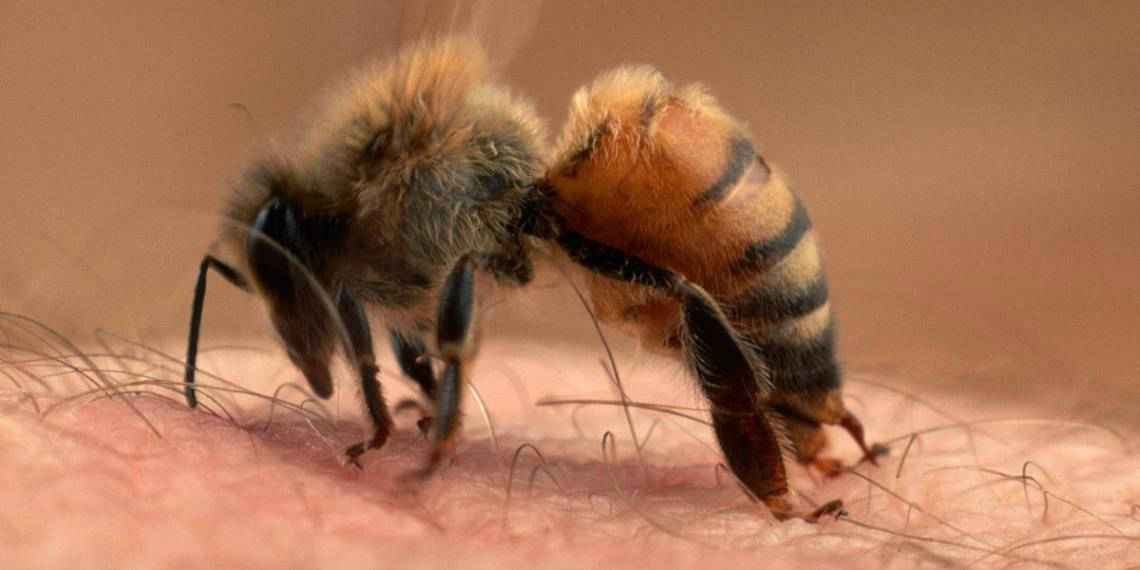 Picaduras de abeja: Desde molestias comunes hasta emergencias médicas