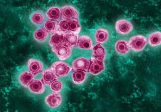 Si tuviste varicela, podrías padecer herpes zóster