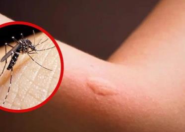 Suman 101 muertes por dengue en México