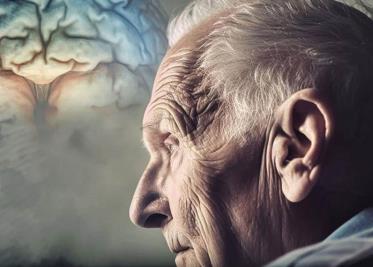 Alzheimer: Demencia Fatal en Adultos Mayores