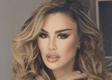 Ninel Conde revela la verdad sobre su nueva apariencia